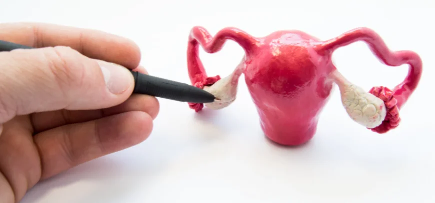 Ovulation induction treatment with dr avani reddy